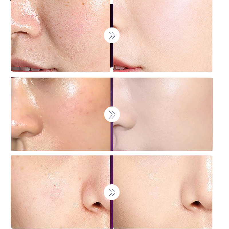Luxo nobre senhora pérola bran - Luxury Skincare Moisturizer avaliação e preço
